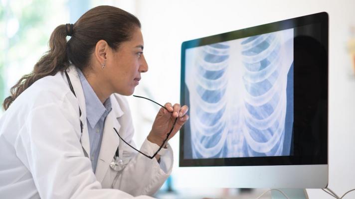 Doctor holding eyeglasses reviews chest imaging on a computer monitor.